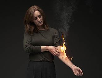 A woman with simulated atopic dermatitis gazes downward and scratches a diffuse lesion on her left arm due to the severe itch she suffers